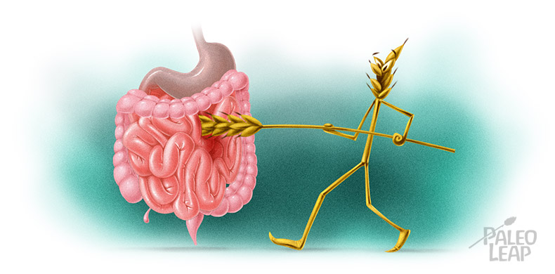Антитела, свързани с целиакията, и цитокин IL-17A при български пациенти с дерматитис&nbsp;херпетиформис