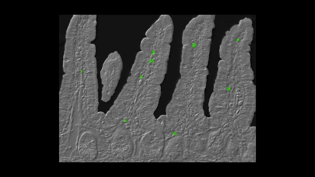 Стоенето до късно през нощта увеличава патологичните Тh17 лимфоцити в&nbsp;червата