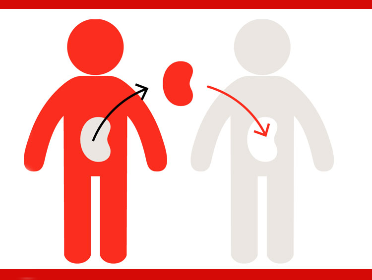 Защо част от бъбречните трансплантации се провалят дори при пълно HLA&nbsp;съвпадение